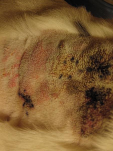 Skin lesion